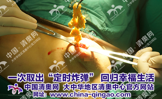 奥美定危害