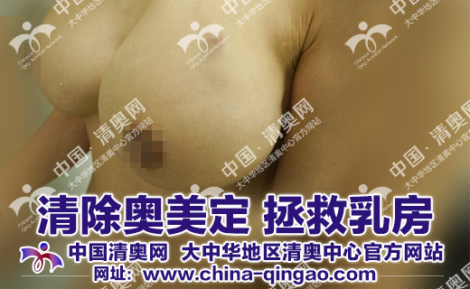 奥美定