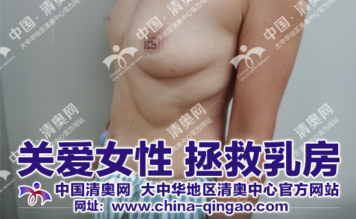 奥美定